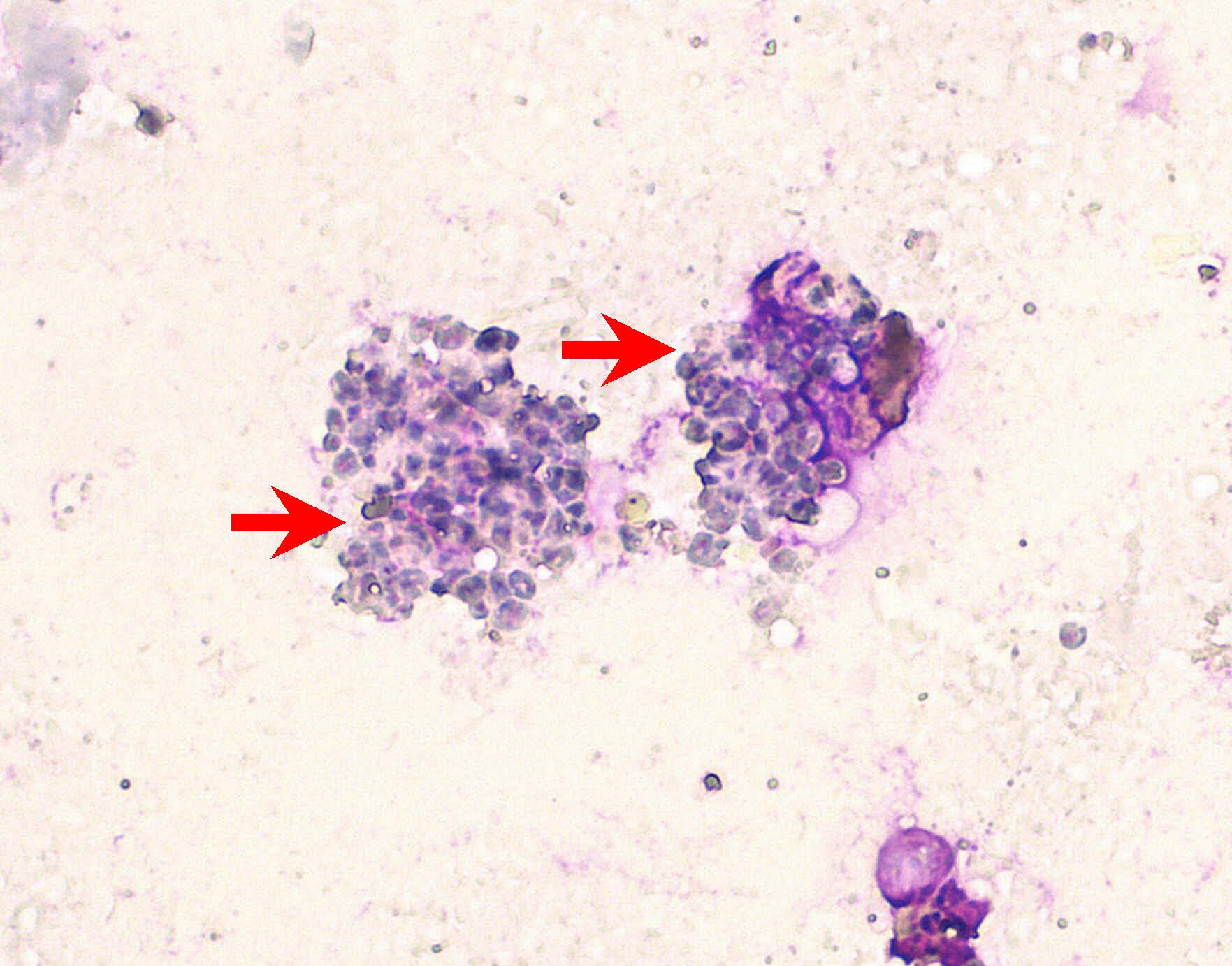 Pneumocystis in CKCS Figure 1