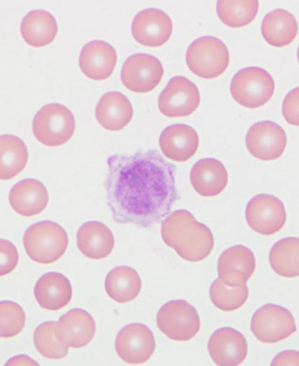 CKCS giant platelet on blood smear (Univ. Minn. 2013)