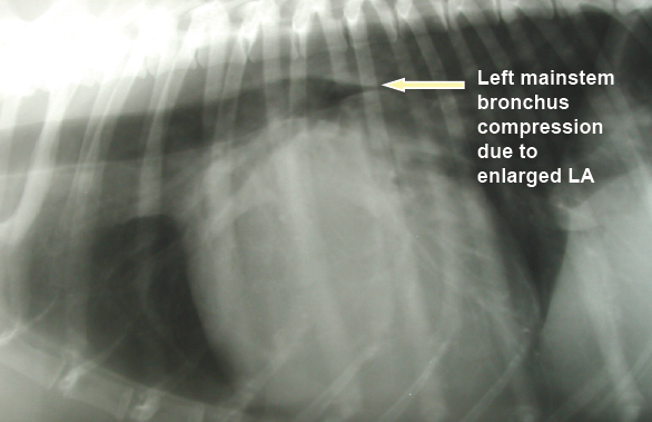 X-ray showing enlarged heart causing coughing