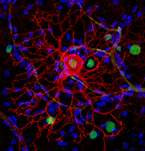 A dog's retinal ganglion cell expressing LiGluR (red) can be controlled by light after delivering a chemical photoswitch.