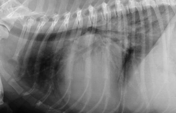 Enlarged left atrium on x-ray
