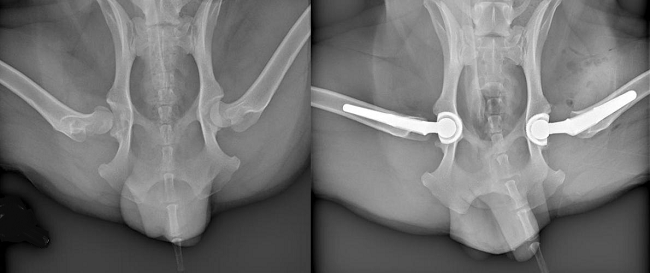 Hip Replacement Surgery