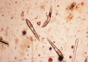 Demodex on CKCS